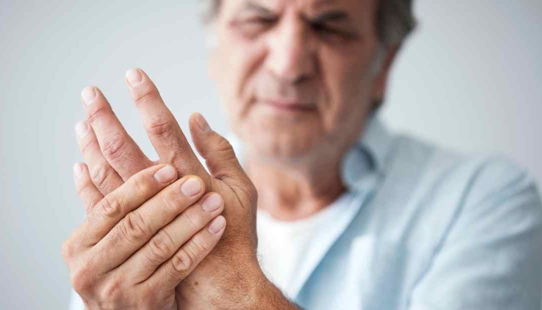 Naproxeno, una opción eficaz en artritis reumatoidea