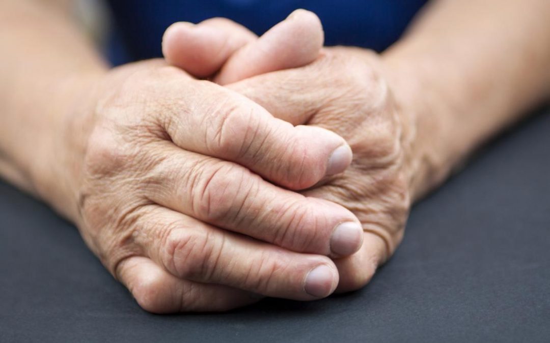 Hidroxicloroquina: menor riesgo de eventos cardiovasculares mayores en artritis reumatoidea